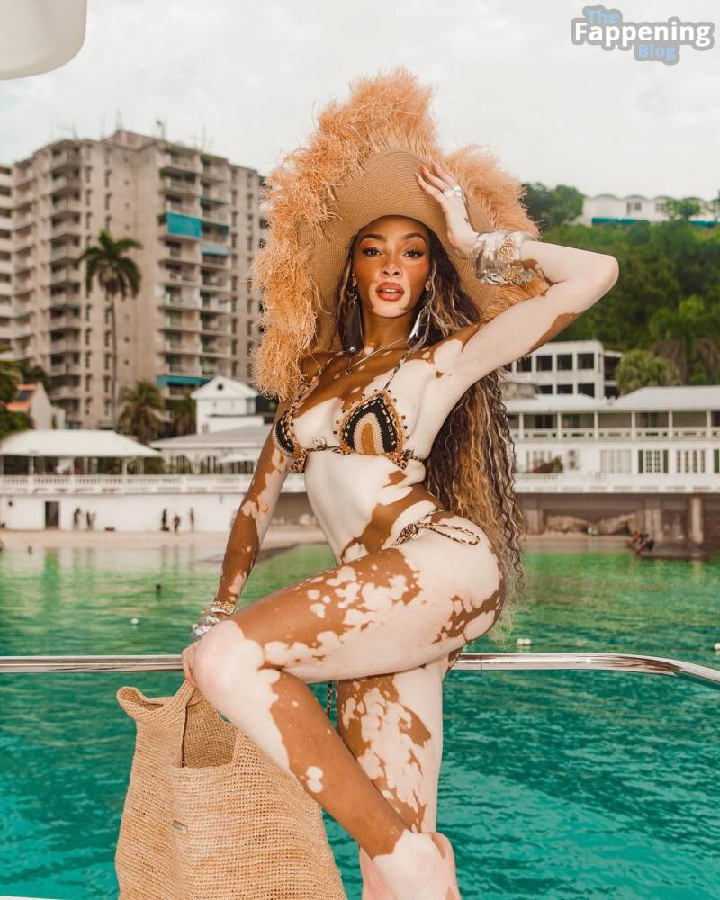 Winnie Harlow Sexy (19 Photos) - #8